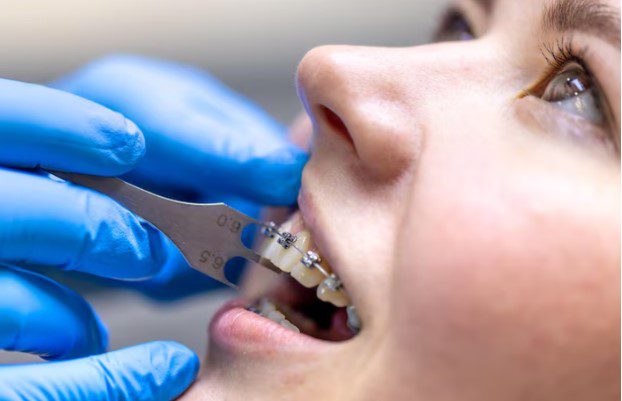 Orthodontics in Bonita Springs, Florida